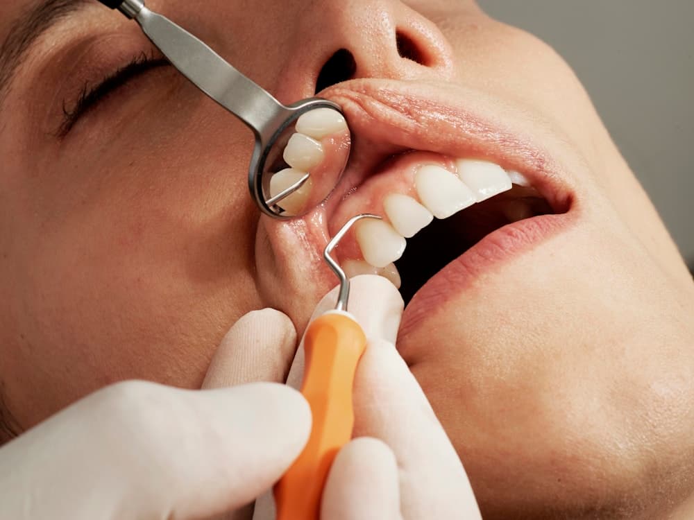 Endodoncia